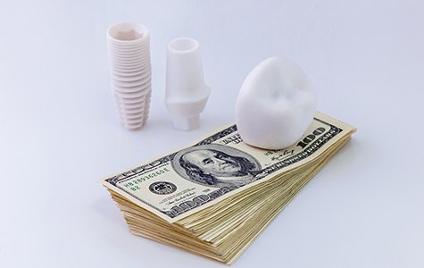 Parts of dental implants next to stack of money