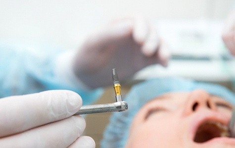 Oral surgeon placing dental implants